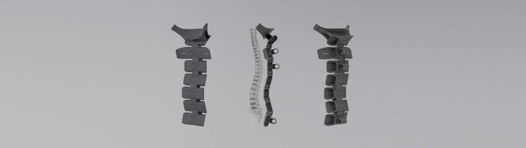 PolySpine modular spinal support system